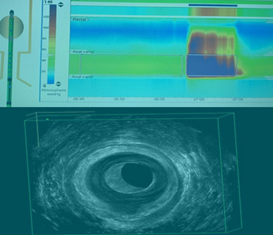 Fisiologia Anorrectal